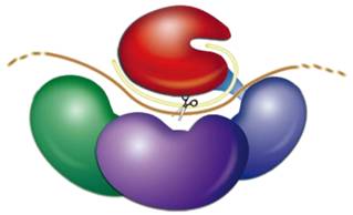 原发性心脏肿瘤有哪些表现？